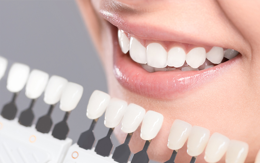 千葉県流山市・ほんだ歯科医院おおたかの森・デュアルホワイトニング